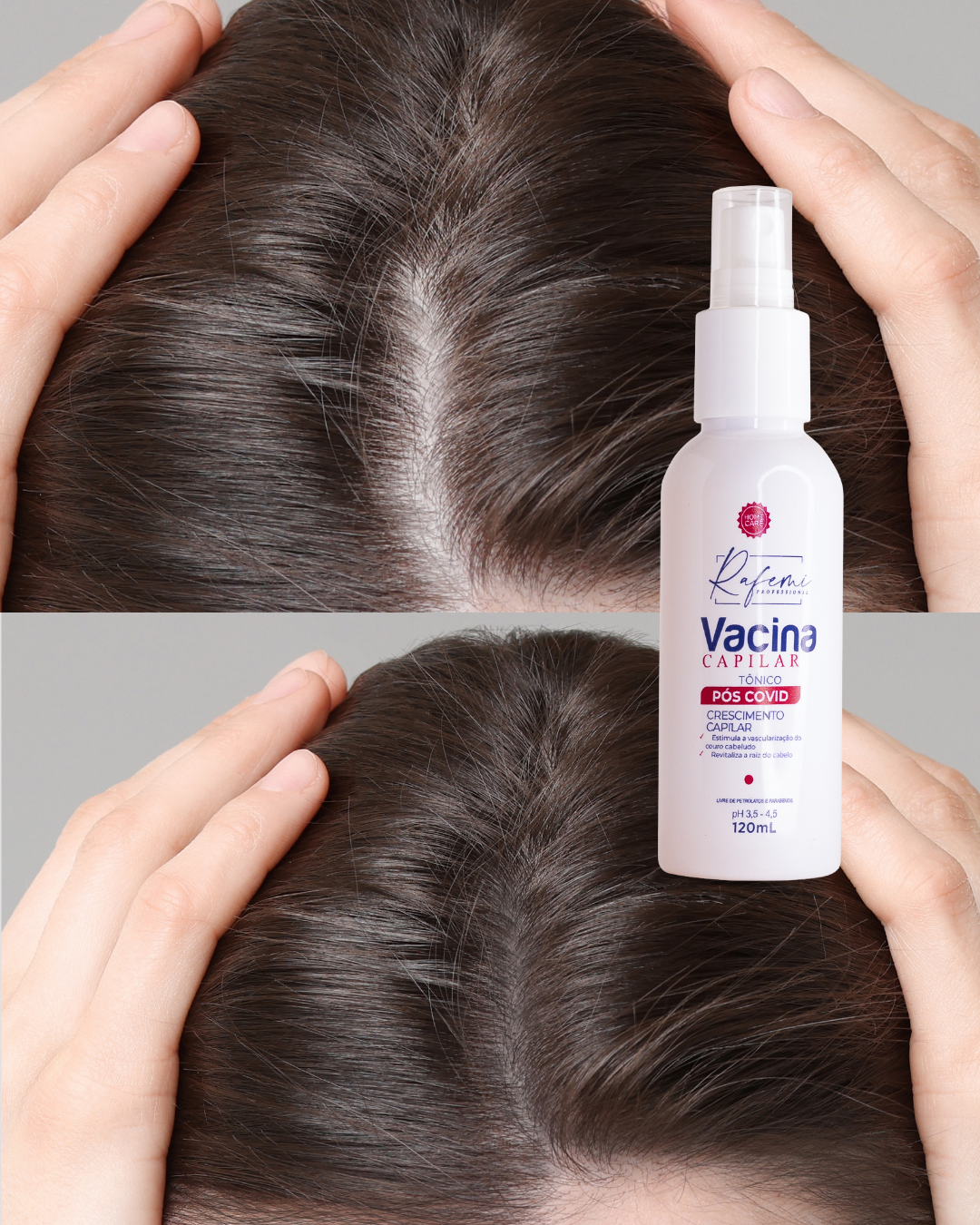 Tônico força e crescimento | Crescimento Capilar | Contém Minoxidil
